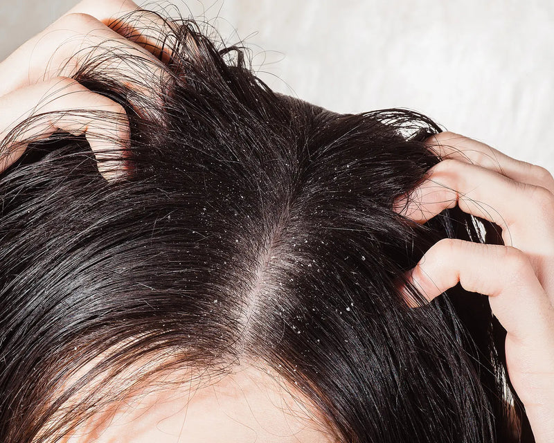 Scalp Exfoliation: How To, How Often & DIY Scalp Scrub Recipes