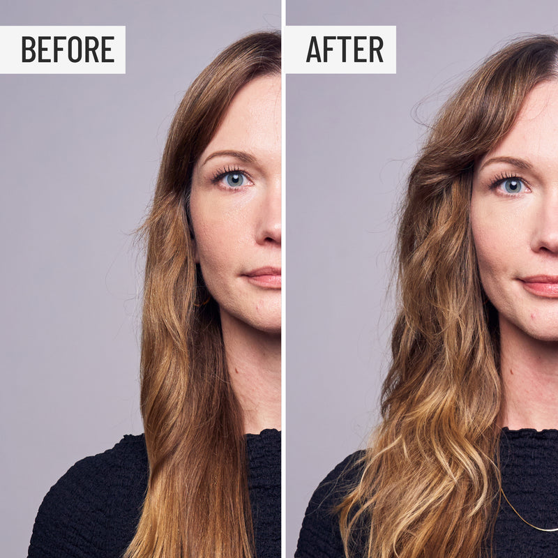 Root Lift